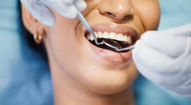 Best Broken or Cracked Tooth Emergency Dentist in Warren, OR